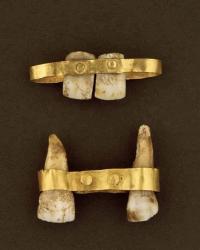 Dentiere etrusche di 2600 anni