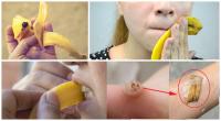 Banana Peel: After Reading This You Will Never Throw A Banana Peel Again