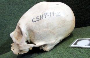 The elongated skull of a child discovered on the shores of Titicaca's lake
