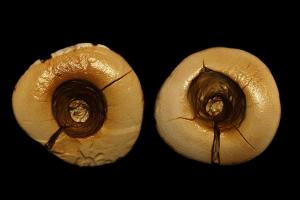 Oldest Dental Filling: Discovering Bitumen and Hairs in Ancient Teeth