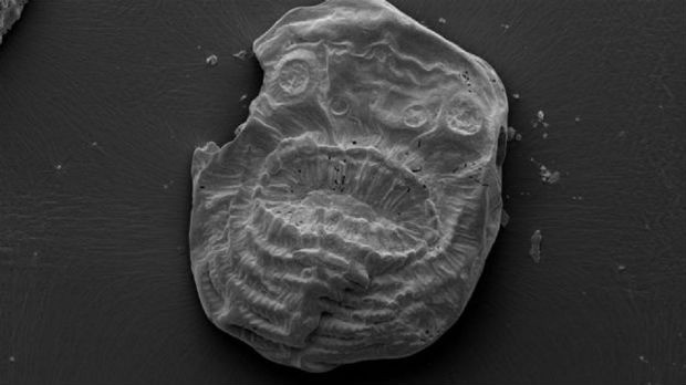 Fossil of Saccorhytus coronarius (electron microscope image)