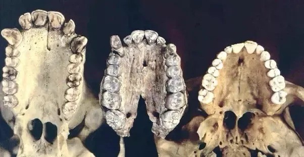 Evolution of teeth
