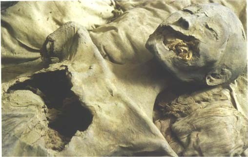 Detail of mummy 61072