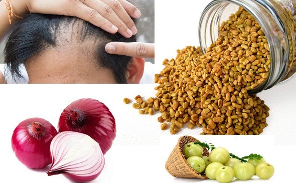 Remedies to avoid baldness