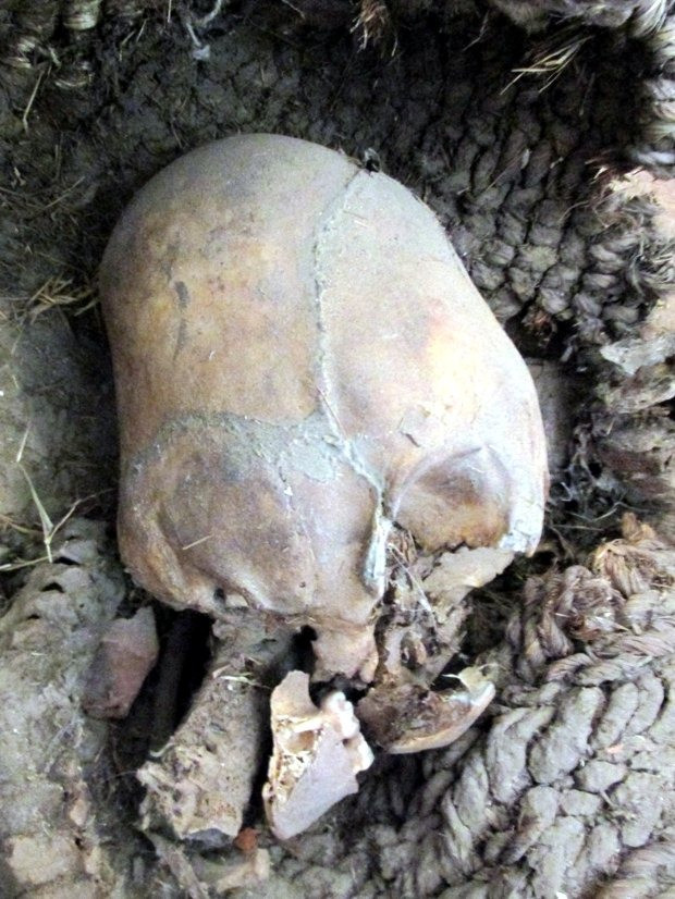 The elongated skull of a child discovered on the shores of Titicaca's lake