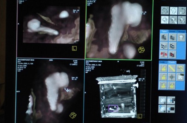 CT images of the box, showing the bundle and the tooth.