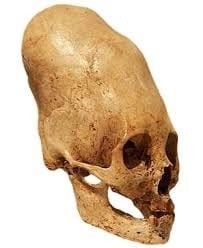 Elongated skull